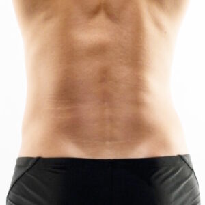 Triangulo Sacrocoxial Hombres - Depilación Láser