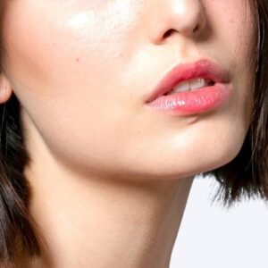 Borde maxilar Mujeres - Depilación Láser