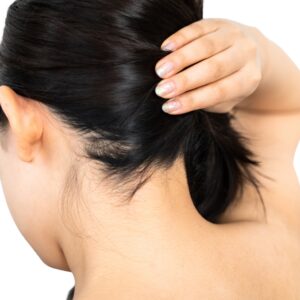 Nuca Mujeres - Depilación Láser