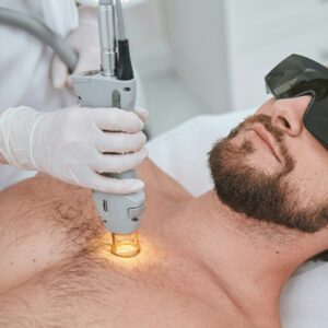 Depilación Láser Hombre